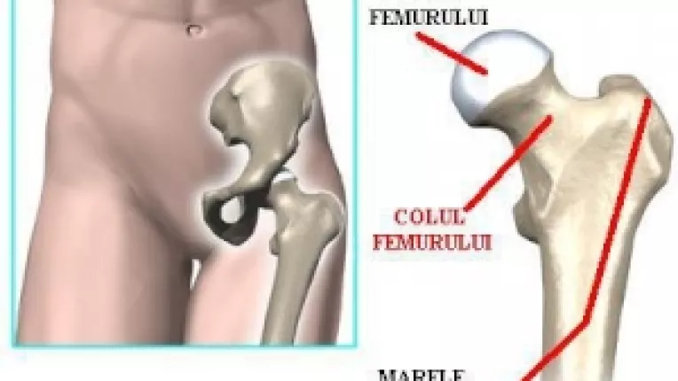 Angela Merkel a suferit o fractura de bazin in timpul unei caderi la schi 